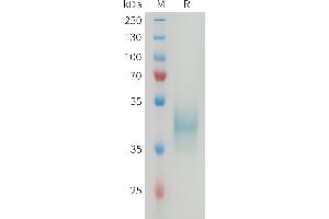 Mouse CD24 Protein, hFc Tag on SDS-PAGE under reducing condition.