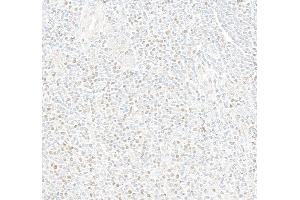 Immunohistochemistry (IHC) image for anti-Myocyte Enhancer Factor 2C (MEF2C) (AA 425-475) antibody (ABIN7795747) (Recombinant MEF2C anticorps  (AA 425-475))