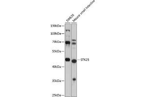 Western blot analysis of extracts of various cell lines, using STK25 antibody (ABIN6132842, ABIN6148604, ABIN6148605 and ABIN6225078) at 1:1000 dilution. (STK25 anticorps  (AA 297-426))