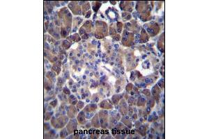 MLM Antibody (C-term) (ABIN6242125 and ABIN6577331) immunohistochemistry analysis in formalin fixed and paraffin embedded human pancreas tissue followed by peroxidase conjugation of the secondary antibody and DAB staining. (Cutaneous Malignant Melanoma/dysplastic Nevus anticorps  (C-Term))