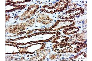 anti-IlvB (Bacterial Acetolactate Synthase)-Like (ILVBL) antibody