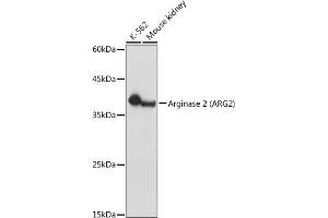 Western blot analysis of extracts of various cell lines, using Arginase 2  antibody (ABIN6131236, ABIN6137078, ABIN6137079 and ABIN6221969) at 1:1000 dilution. (ARG2 anticorps  (AA 1-354))