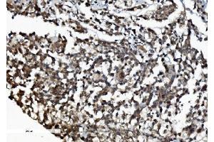 IHC analysis of DDX1 using anti-DDX1 antibody (ABIN7602051).