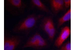 Immunofluorescence staining of methanol-fixed Hela cells using Phospho-MARCKS-S162 antibody.