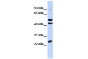 Image no. 1 for anti-Zinc Finger Protein 200 (ZNF200) (AA 324-373) antibody (ABIN6742764) (ZNF200 anticorps  (AA 324-373))