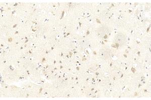 Immunohistochemical analysis of paraffin-embedded Human brain section using LINGO-1(LRRN6A)- (C-term) Antibody (ABIN651289 and ABIN2840172).