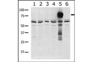 Western blot analysis of anti-K5 b (ABIN392438 and ABIN2842036) in lysates from transiently transfected COS7 cells. (PAK7 anticorps  (AA 168-198))