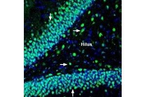 Expression of NHE-6 in rat hippocampus - Immunohistochemical staining of perfusion-fixed frozen rat brain sections with Anti-Na+/H+ Exchanger 6 (NHE-6) Antibody (ABIN7043760, ABIN7044871 and ABIN7044872), (1:200), followed by goat-anti-rabbit-AlexaFluor-488.