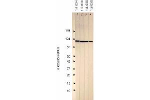 Western Blotting (WB) image for anti-Herpes Simplex Virus Type 1 ICP0 (HSV1 ICP0) antibody (ABIN265559) (HSV1 ICP0 anticorps)