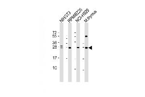 All lanes : Anti-FGFR1OP2 Antibody at 1:4000 dilution Lane 1: NIH/3T3 whole cell lysate Lane 2: R whole cell lysate Lane 3: NCI- whole cell lysate Lane 4: mouse thymus lysate Lysates/proteins at 20 μg per lane. (FGFR1OP2 anticorps  (AA 1-172))