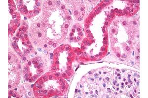 Anti-FIH / CASR antibody IHC of human kidney, tubules.