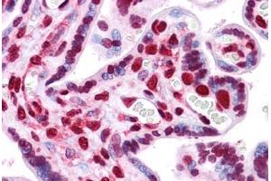 Human Placenta: Formalin-Fixed, Paraffin-Embedded (FFPE)