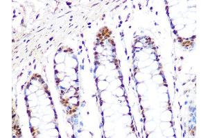 Immunohistochemistry of paraffin-embedded human colon using PRMT1 Rabbit mAb  at dilution of 1:100 (40x lens).