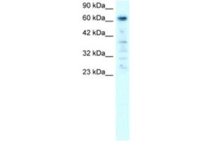 Western Blotting (WB) image for anti-Poly (ADP-Ribose) Polymerase Family, Member 3 (PARP3) antibody (ABIN2460803) (PARP3 anticorps)