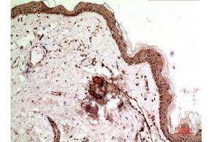 Immunohistochemistry (IHC) analysis of paraffin-embedded Human Skin, antibody was diluted at 1:100. (Synovial Sarcoma, X Breakpoint 2B (SSX2B) (C-Term) anticorps)