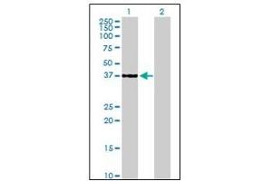 Western Blotting (WB) image for anti-Cyclin-Dependent Kinase 6 (CDK6) antibody (ABIN781963)