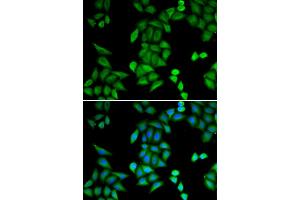 Immunofluorescence analysis of MCF-7 cells using RBPJ antibody. (RBPJ anticorps)