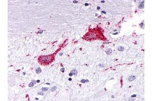 Immunohistochemical staining of Brain (Neurons and glia) using anti- KISS1R antibody ABIN122164 (KISS1R anticorps  (Cytoplasmic Domain))