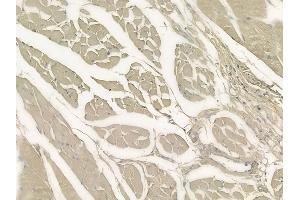 ABIN6264770 and ABIN6273310 at 1/100 staining human tongue carcinoma by IHC-P.