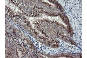 Image no. 11 for anti-Diphthamide Biosynthesis Protein 2 (DPH2) antibody (ABIN1497893) (DPH2 anticorps)