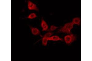 ABIN6274884 staining Hela by IF/ICC. (ABCD1 anticorps  (Internal Region))