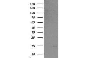 Western Blotting (WB) image for anti-Chromosome 17 Open Reading Frame 37 (C17orf37) antibody (ABIN1501777) (C17orf37 anticorps)
