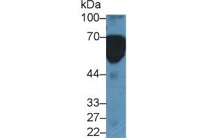 Detection of HMWK in Human Serum using Polyclonal Antibody to High Molecular Weight Kininogen (HMWK)