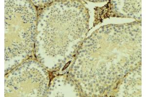 ABIN6275107 at 1/100 staining Mouse testis tissue by IHC-P. (ELOVL5 anticorps  (C-Term))