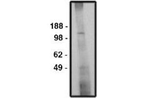 Image no. 1 for anti-Solute Carrier Family 9 (Sodium/hydrogen Exchanger), Member 6 (SLC9A6) antibody (ABIN265251) (SLC9A6 anticorps)