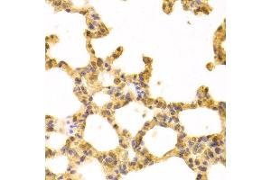 Immunohistochemistry (IHC) image for anti-Ubiquitin-Conjugating Enzyme E2I (UBE2I) (AA 1-158) antibody (ABIN3023178)