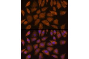 Immunofluorescence analysis of L929 cells using GCLC Rabbit pAb (ABIN6130444, ABIN6141016, ABIN6141017 and ABIN6214615) at dilution of 1:100 (40x lens). (GCLC anticorps  (AA 1-252))