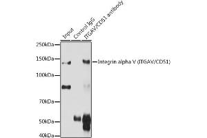 Immunoprecipitation analysis of 200 μg extracts of C6 cells using 3 μg Integrin alpha V (ITGAV/CD51) antibody (ABIN3022887, ABIN3022888, ABIN3022889 and ABIN6219281). (CD51 anticorps  (C-Term))