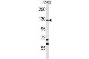Western Blotting (WB) image for anti-MCF.2 Cell Line Derived Transforming Sequence (MCF2) antibody (ABIN2996823) (MCF2 anticorps)