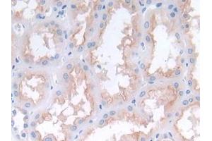 Detection of MCP2 in Human Kidney Tissue using Polyclonal Antibody to Monocyte Chemotactic Protein 2 (MCP2)