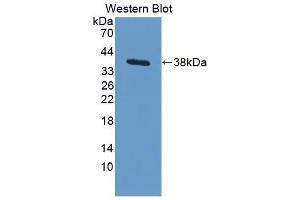 Detection of Recombinant ARPC2, Human using Polyclonal Antibody to Actin Related Protein 2/3 Complex Subunit 2 (ARPC2) (ARPC2 anticorps  (AA 1-300))