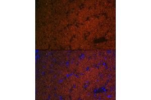 Immunofluorescence analysis of mouse brain using CNPase Rabbit mAb (ABIN7265322) at dilution of 1:100 (40x lens). (Cnpase anticorps)