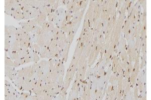 ABIN6262924 and ABIN6277599 at 1/100 staining Mouse heart tissue by IHC-P. (Lamin B Receptor anticorps  (Internal Region))