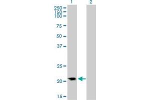Western Blot analysis of RHOA expression in transfected 293T cell line by RHOA monoclonal antibody (M05), clone 1C1. (RHOA anticorps  (AA 1-193))