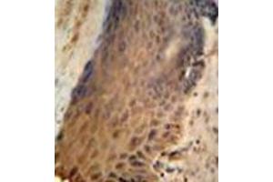 Immunohistochemistry analysis in formalin fixed and paraffin embedded human skin reacted with GFPT2 / GFAT2 Antibody (Center) followed which was peroxidase conjugated to the secondary antibody and followed by DAB staining. (GFPT2 anticorps  (Middle Region))