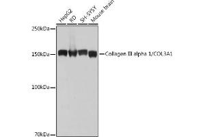 Western blot analysis of extracts of various cell lines, using Collagen III alpha 1/COL3 antibody (ABIN7266459) at 1:1000 dilution. (COL3 anticorps)