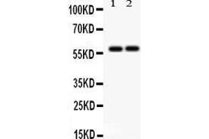 Anti-SCARB1 Picoband antibody, Western blotting All lanes: Anti SCARB1  at 0. (SCARB1 anticorps  (C-Term))