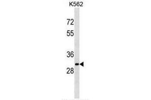 SULT1A2 Antibody (C-term) western blot analysis in K562 cell line lysates (35µg/lane). (SULT1A2 anticorps  (C-Term))