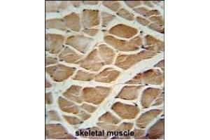 DM1- Antibody (N-term) (ABIN651631 and ABIN2840337) immunohistochemistry analysis in formalin fixed and paraffin embedded human skeletal muscle tissue followed by peroxidase conjugation of the secondary antibody and DAB staining.