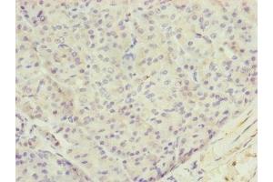 Immunohistochemistry of paraffin-embedded human pancreatic tissue using ABIN7173719 at dilution of 1:100 (TTLL7 anticorps  (AA 1-260))