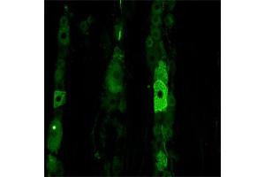 IF on rat trigeminal using Mouse monoclonal antibody to rat p75NTR (ABIN350707) at a concentration of 10 µg/ml.