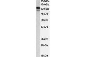 Western Blotting (WB) image for anti-SATB Homeobox 1 (SATB1) (AA 668-681) antibody (ABIN1493900) (SATB1 anticorps  (AA 668-681))