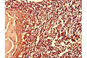 Immunohistochemistry of paraffin-embedded human tonsil tissue using ABIN7174965 at dilution of 1:100 (Myosin X anticorps  (AA 1-97))