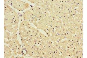Immunohistochemistry of paraffin-embedded human heart tissue using ABIN7157020 at dilution of 1:100