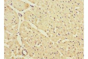 Immunohistochemistry of paraffin-embedded human heart tissue using ABIN7157020 at dilution of 1:100 (KCNJ4 anticorps  (AA 316-445))
