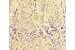 Immunohistochemistry of paraffin-embedded human adrenal gland tissue using ABIN7175563 at dilution of 1:100